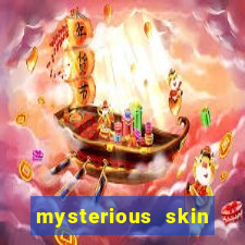 mysterious skin online dublado