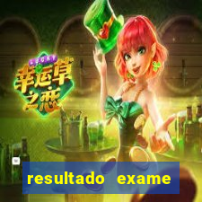 resultado exame eliel figueiredo